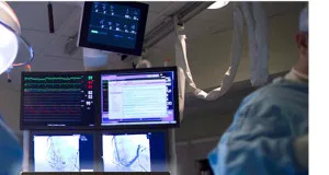 Monitores para electromedicina